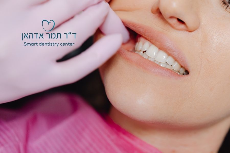 חורים בשיניים2